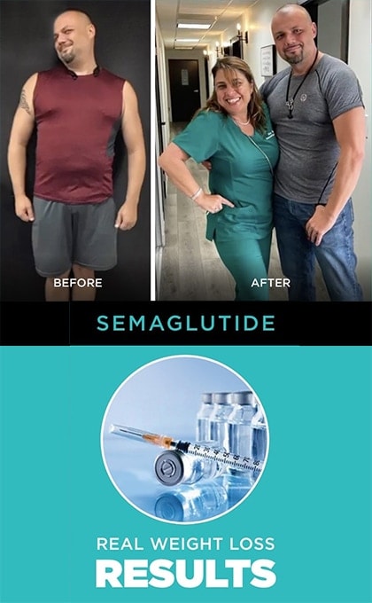 BARxMD semaglutide before and after